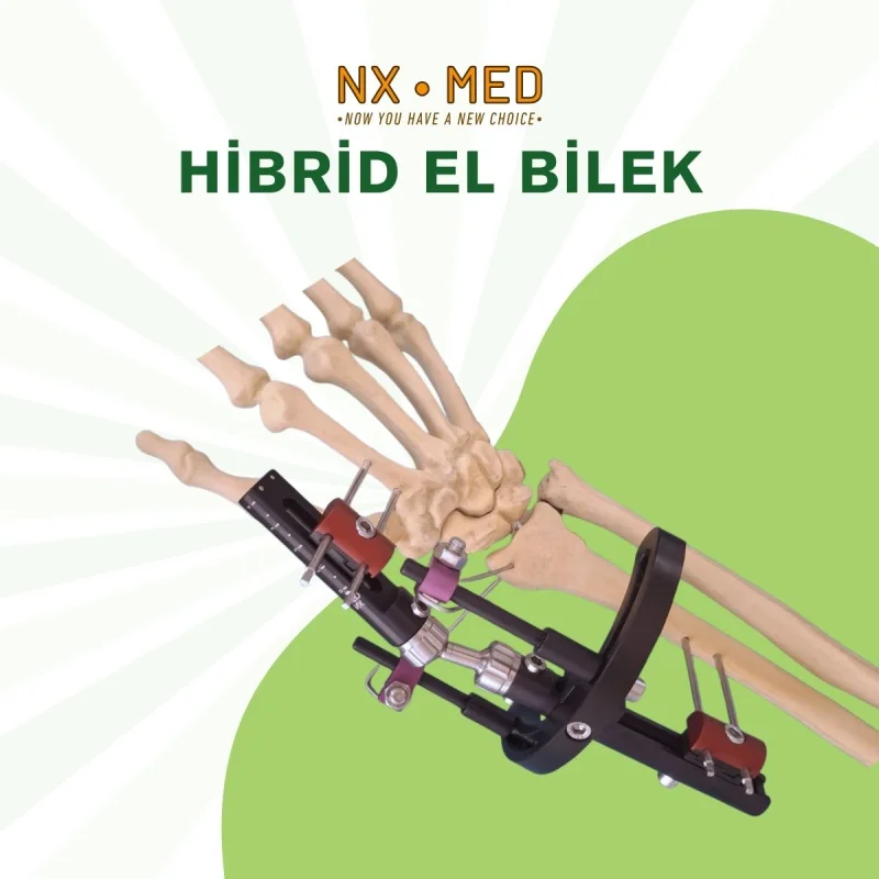 El Bilek Fiksatörleri