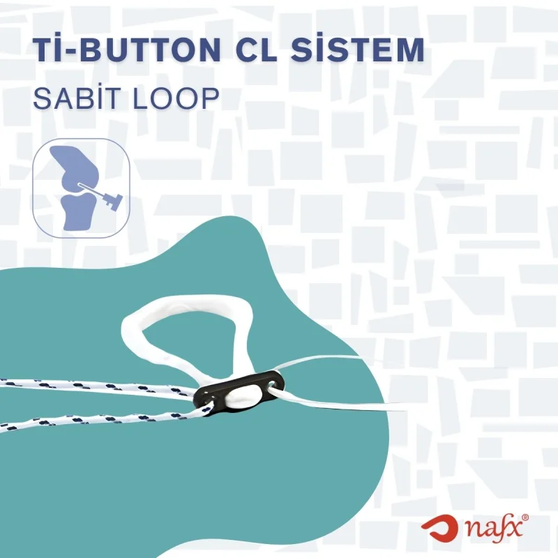 Endobutton