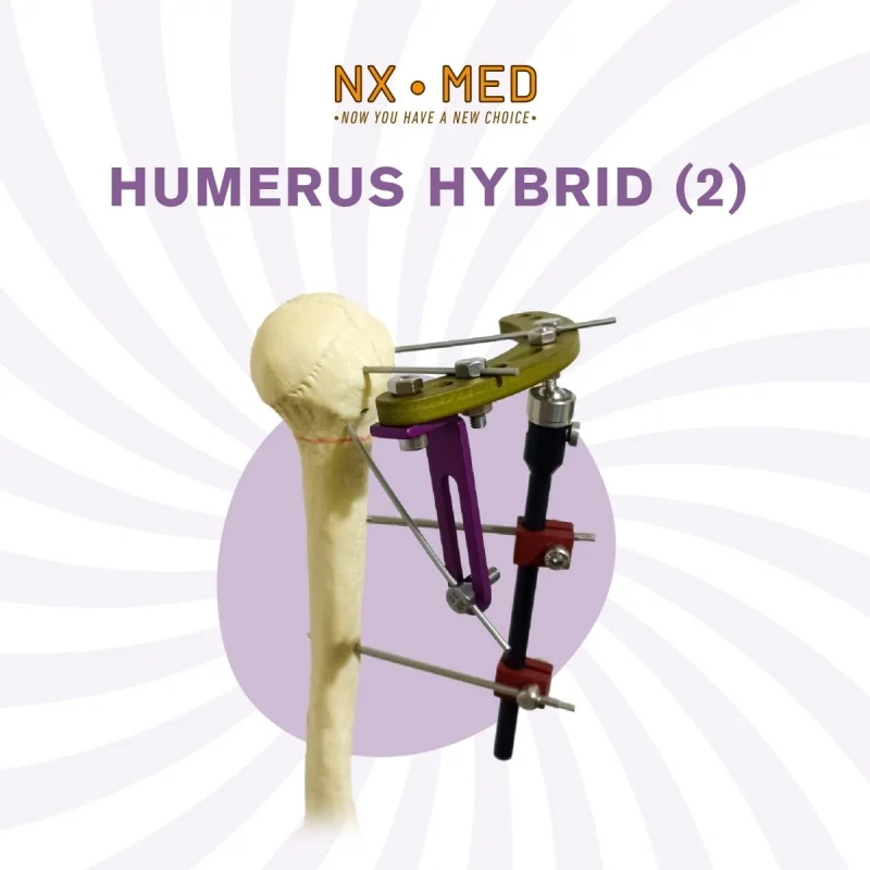 Humerus Proximal Hybrid Fixator