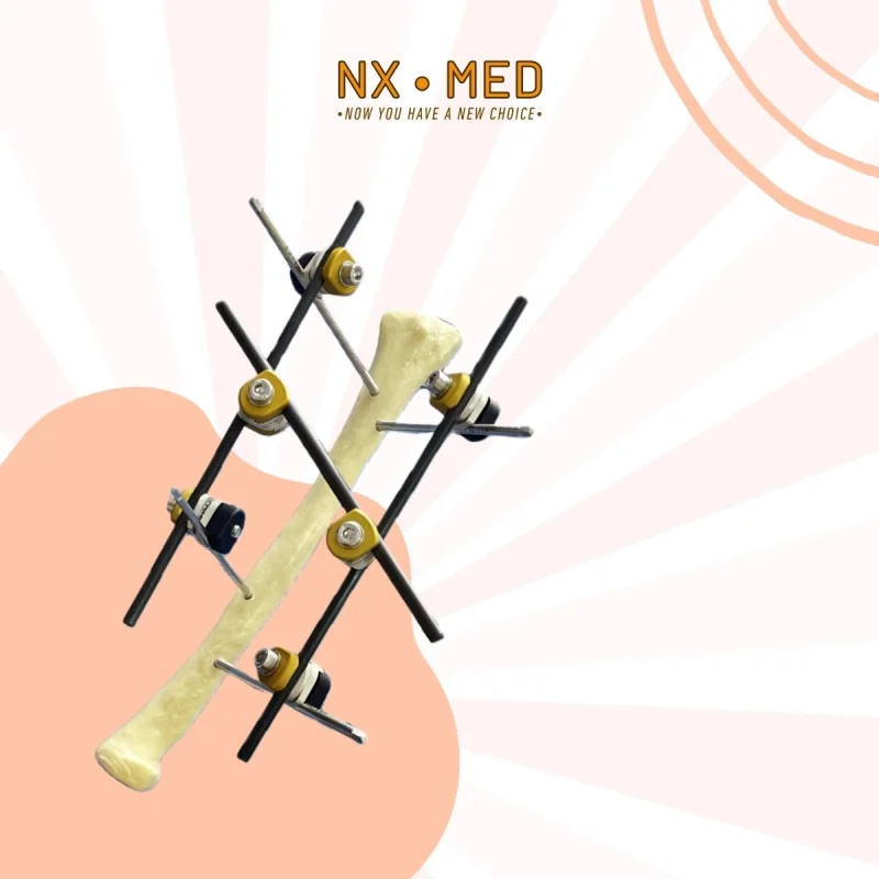 Küçük Tübüler Eksternal Fiksatör 