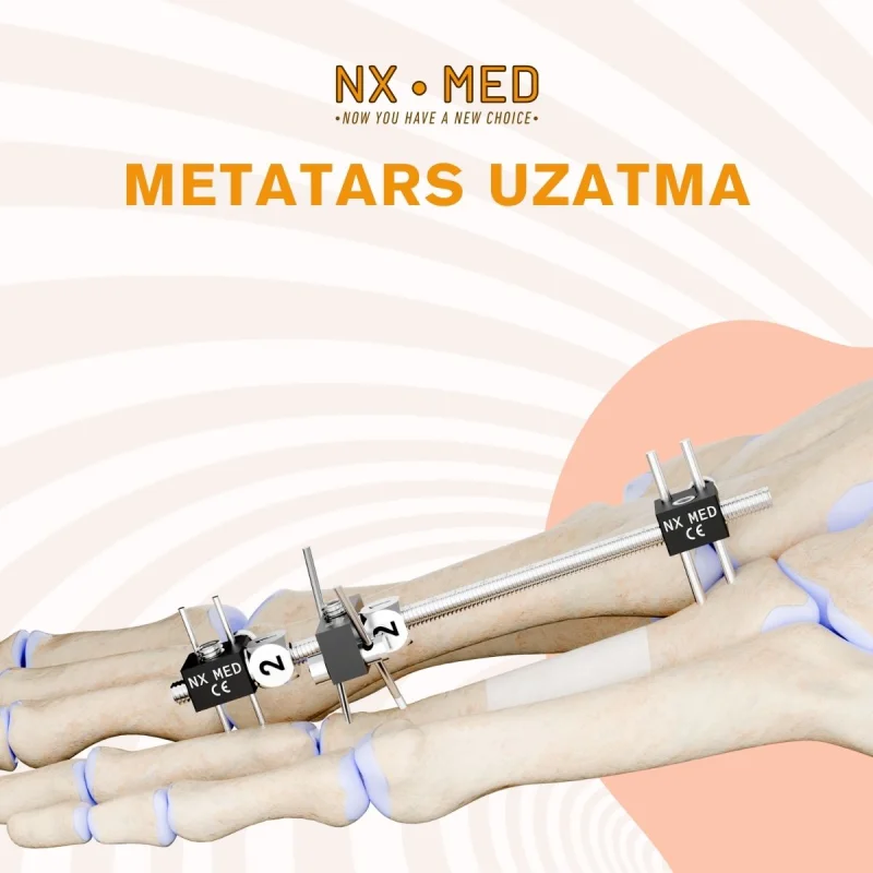 METAFIX
