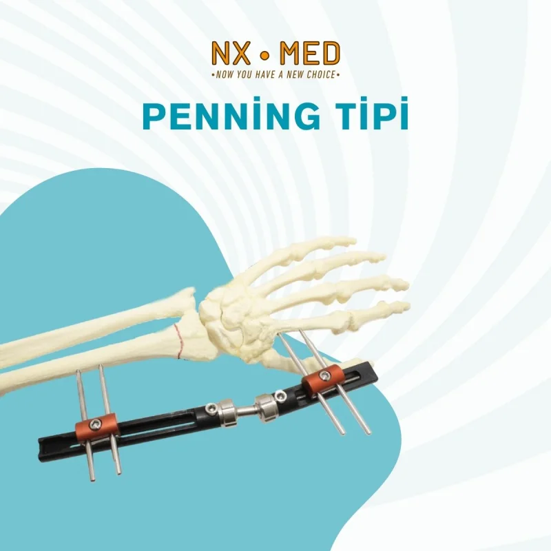 El Bilek Fiksatörleri