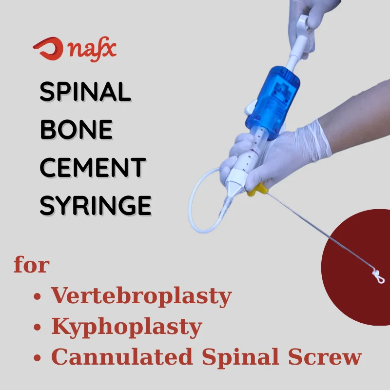 Spinal Bone Cement Syringe