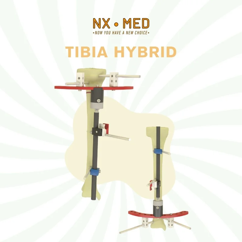 Tibia Hybrid Fixator