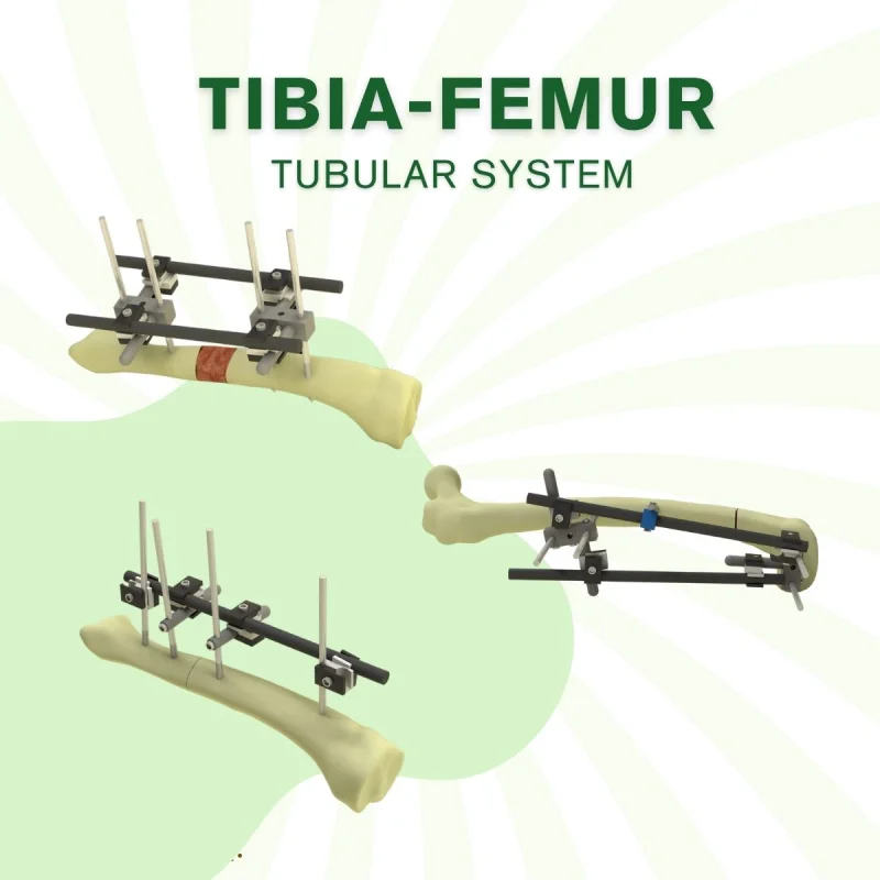 Tubular External Fixator - LARGE - 12 mm System