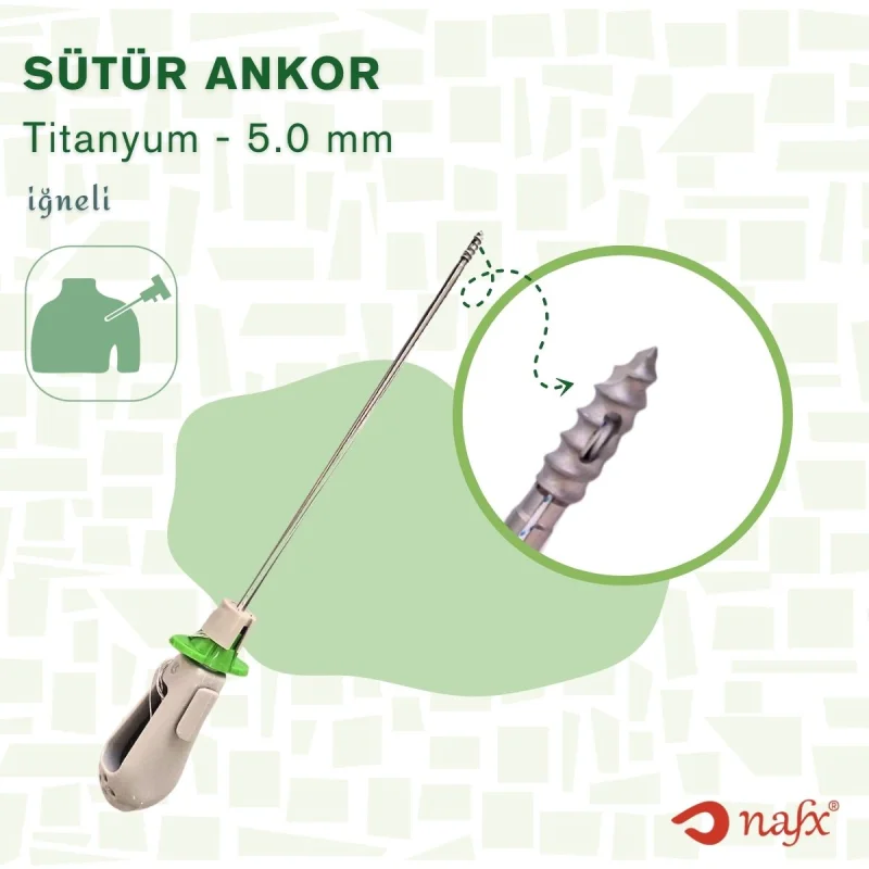 Sütür Ankor