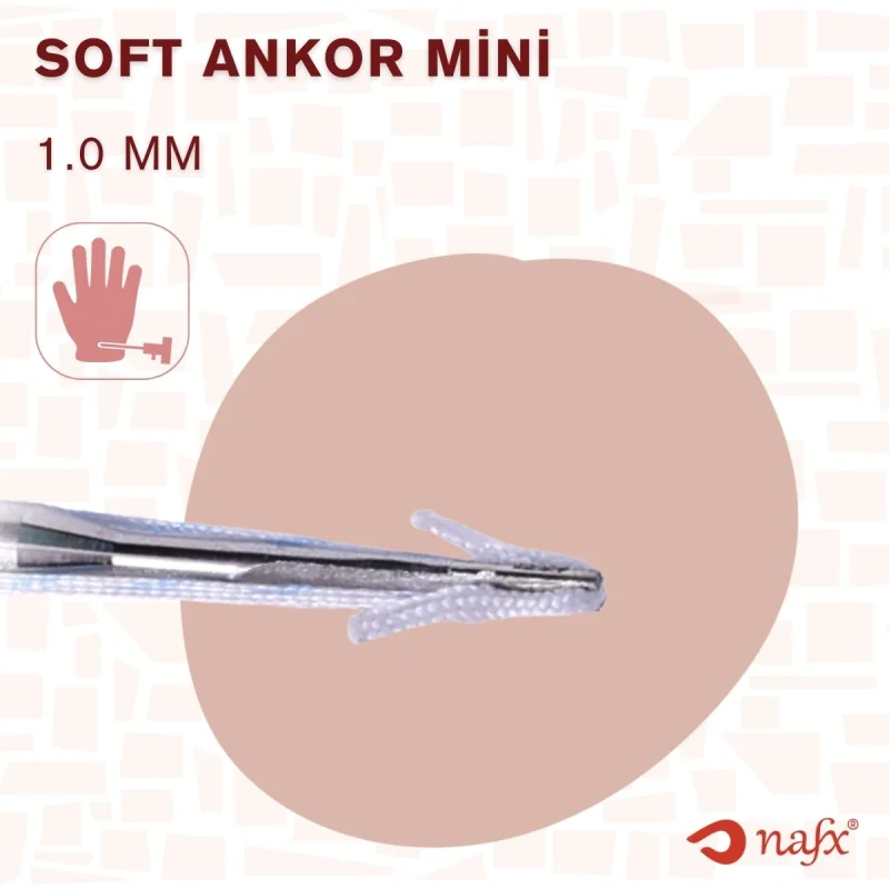 Soft Ankor Mini