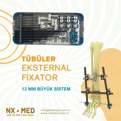 Büyük Tübüler Fiksatör