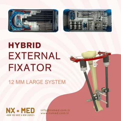 Hybrid External Fixator