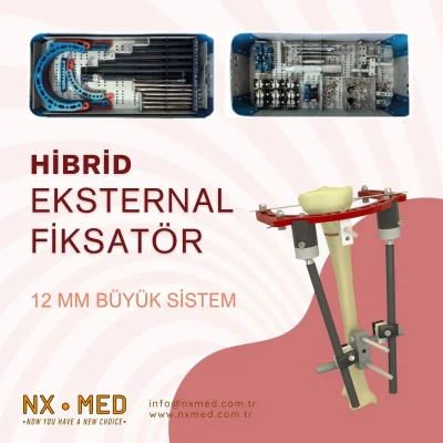 Hibrid Eksternal Fiksatör