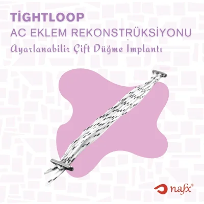 AC Eklem Çift Düğme İmplantı