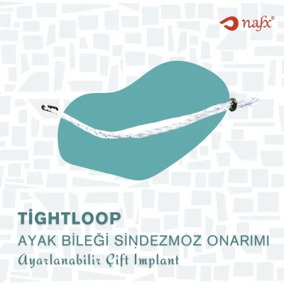 Ayak Bileği Çift Düğme İmplantı