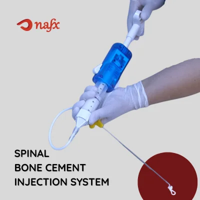 Spinal Bone Cement Syringe