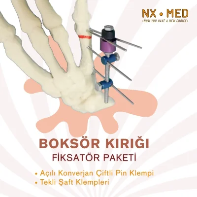 Boksör Kırığı