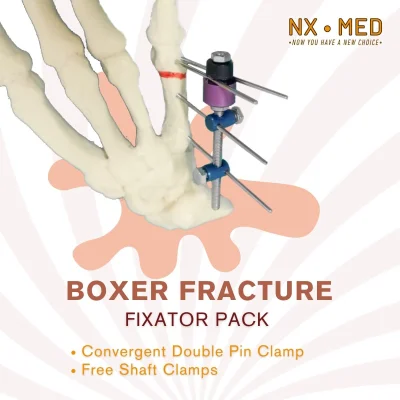 Boxer Fracture
