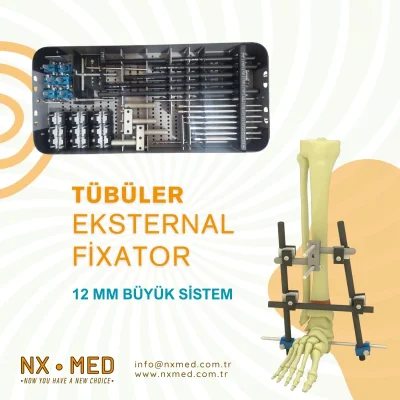 Büyük Tübüler Fiksatör