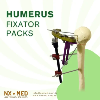 Humerus Proximal Hybrid Fixator