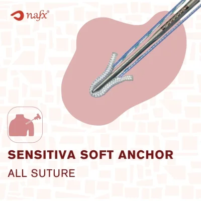 Soft Anchor
