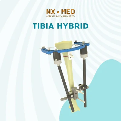 Tibia Hybrid Fixator