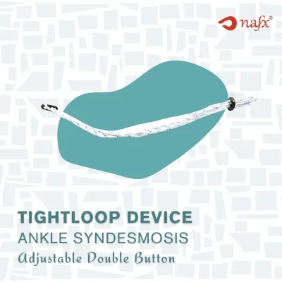 Double Button Implant For Ankle 