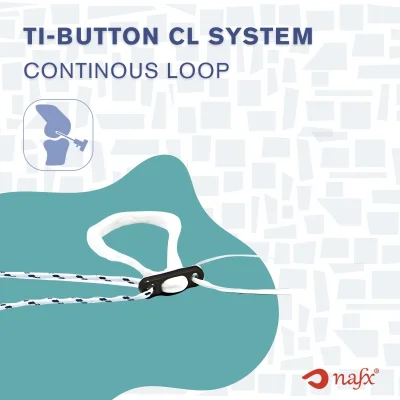 Ti-Button Continuous Loop