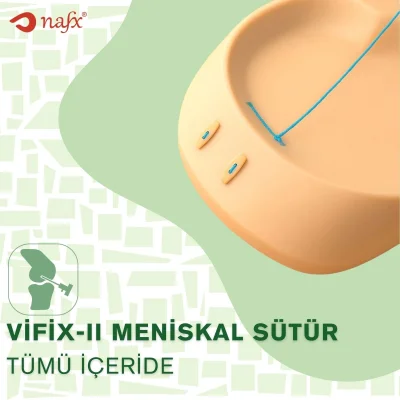Meniskal Sütür Tümü İçeride