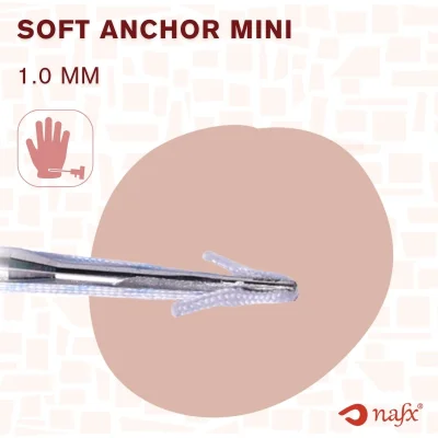 Soft Anchor Mini