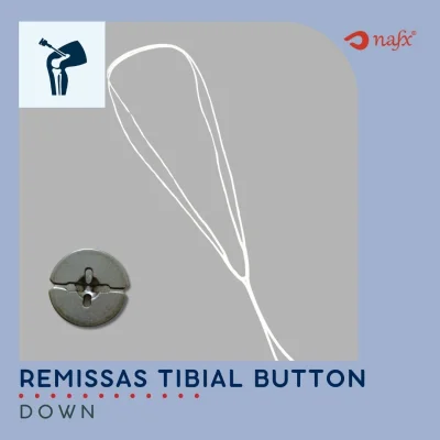 Remissas Hanger Adjustable Button - Tibial