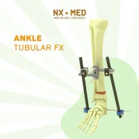 Ankle Fixator