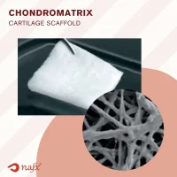 Cartilage Scaffold