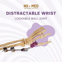 Distractable Wrist Fixator