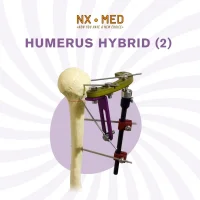 Humerus Proximal Hybrid Fixator