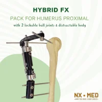 Hybrid Humerus Proximal Fixator Pack