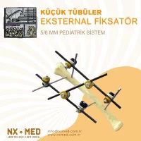 Küçük Tübüler Eksternal Fiksatör 