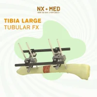 Large Tubular Fixator