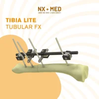 Large Tubular Fixator