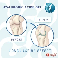 Hyaluronic Acide Gel
