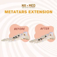 METAFIX