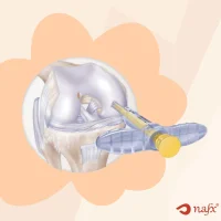 Mosaicplasty Set