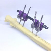 PETNAFX Rod System