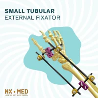 Small Tubular External Fixator - 5/6 mm System