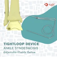 Double Button Implant For Ankle Syndesmosis