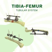 Tubular External Fixator - LARGE - 12 mm System