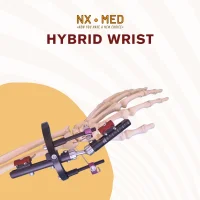 PENEF - Pennig Type Wrist Fixator
