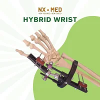 PENEF - Pennig Type Wrist Fixator